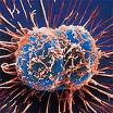 Вирусы герпеса против онкологических заболеваний