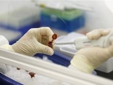 Немецкие вирусологи разработали диагностический тест на свиной грипп