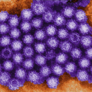 Вспышка норовирусной инфекции затронула три четверти миллиона британцев