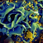 Американцы приблизились к созданию универсальной вакцины от ВИЧ