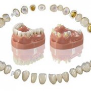 Протезирование зубов возвращает здоровье и красоту