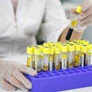 Российские ученые разработали метод диагностики онкозаболеваний по моче