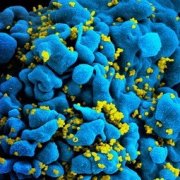 Создан вагинальный гель для защиты от вируса иммунодефицита