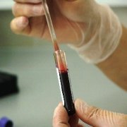 В январе в России выявили почти пять тысяч ВИЧ-инфицированных