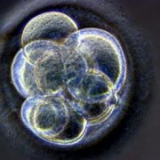 Для лечения сахарного диабета клонировали эмбрион человека