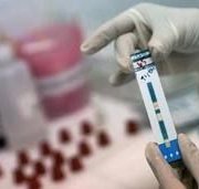 В Киеве будут работать мобильные пункты тестирования на ВИЧ-инфекцию