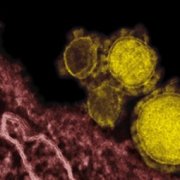 Новый коронавирус впервые обнаружили в Иране