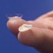 Как производится установка виниров на зубы