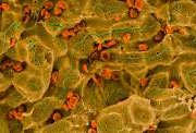 Из стволовых клеток создали клетки печени