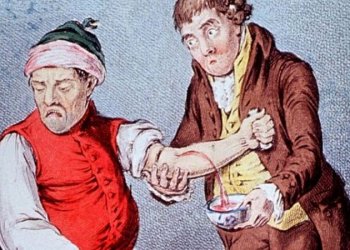 История кровопускания: один из самых древних методов лечения
