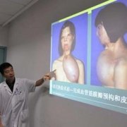 Новое лицо китаянке вырастили на ее груди