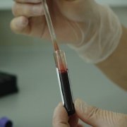 Новый тест крови спасает от ошибочного назначения антибиотиков