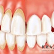 Киадент - все виды стоматологических услуг