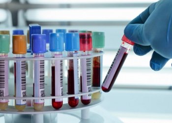 Выявить более 50 видов рака позволяет уникальный анализ крови